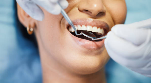 Best Emergency Treatment for Dental Infections or Abscesses in Absecon, NJ